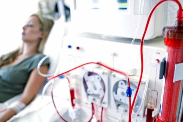 Starting Dialysis Due to Kidney Failure- What to Expect